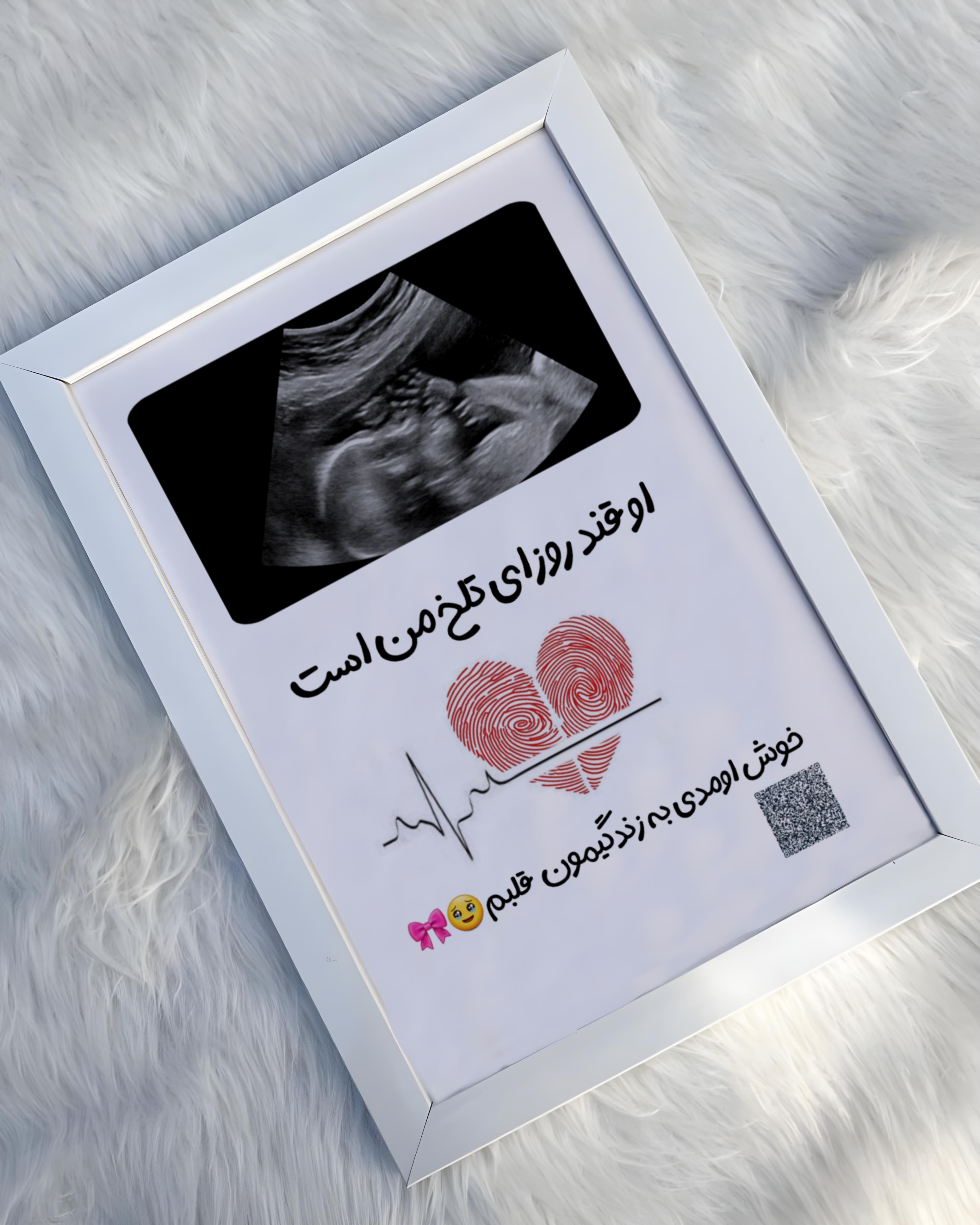 قاب عکسpvc موزیکال سنوگرافی یادگاری